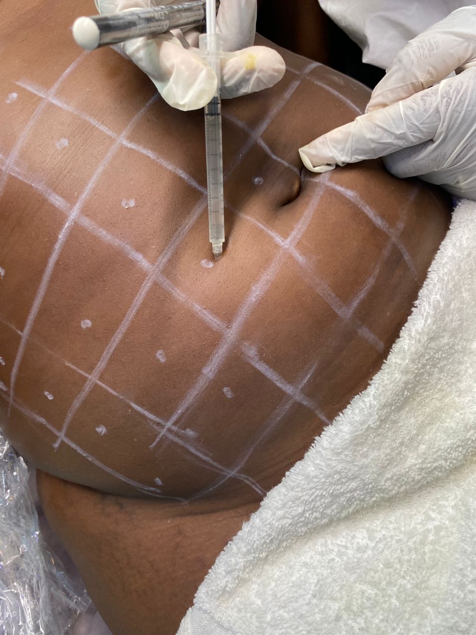 Facial