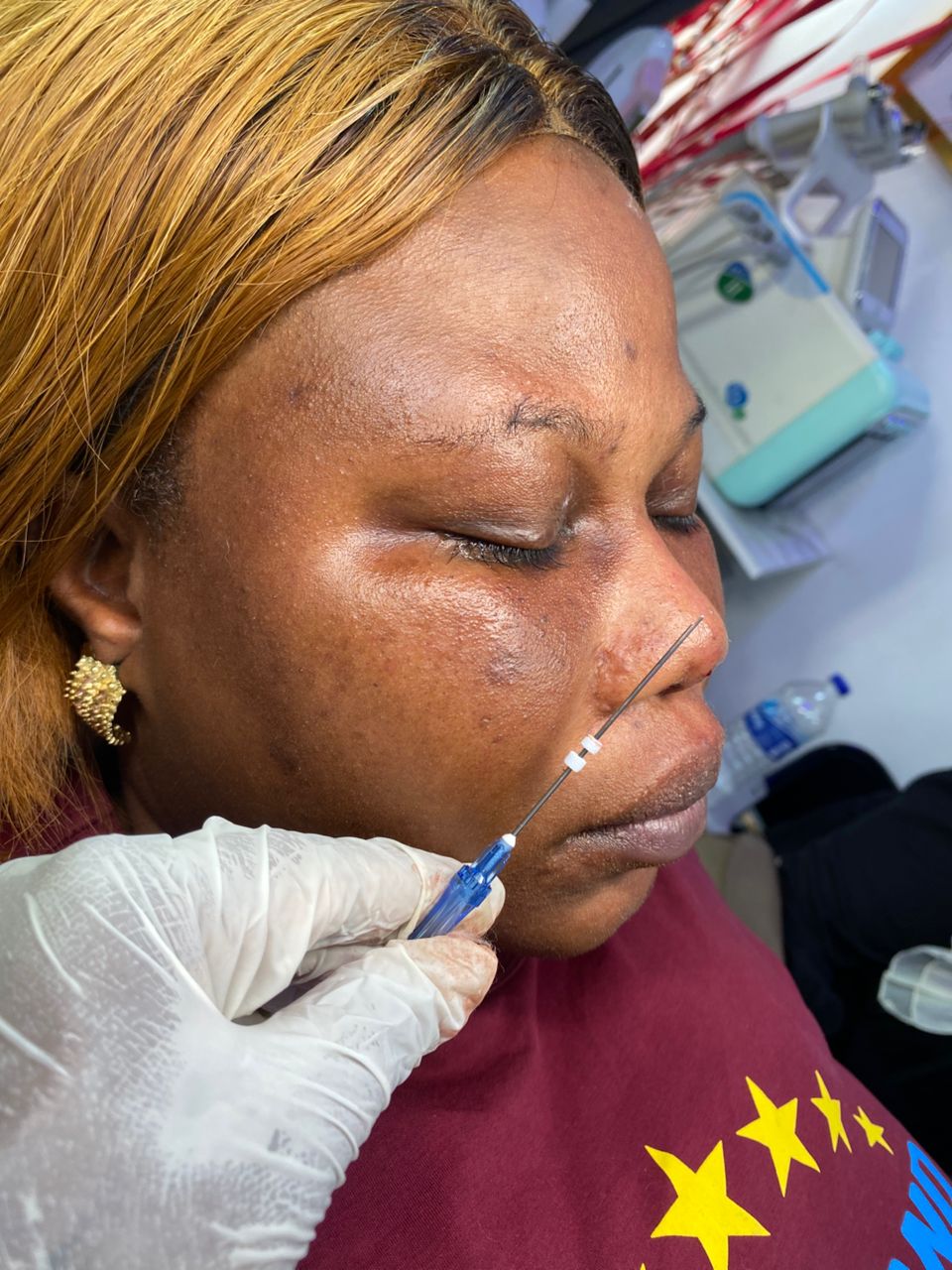 Skin consultation & face analysis